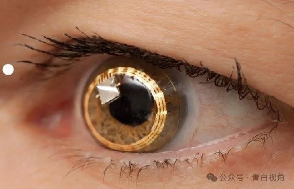 隐形眼镜的未来